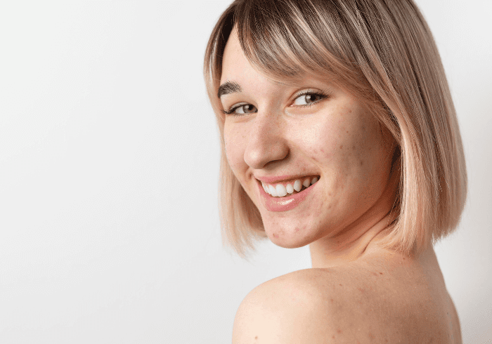 Este colagenul benefic pentru acnee? 1 suplimente cu colagen pentru acnee