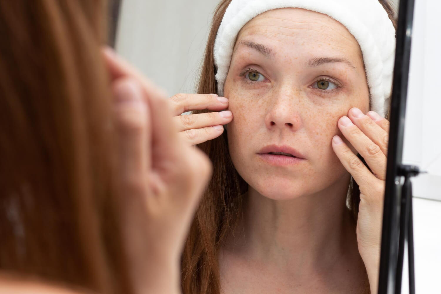 cauze comedoane cauze comedoane