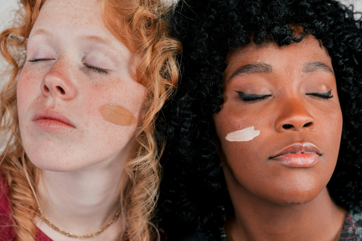 tratament pete pigmentare